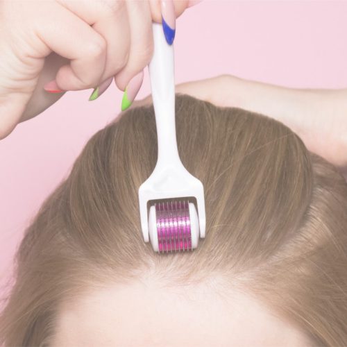 Microneedling For Hair Loss At Home