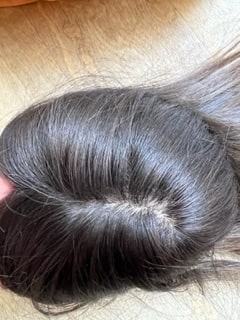 silk top, thinning hair